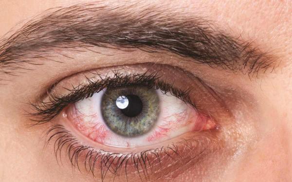 Как связаны цвет глаз и здоровье человека